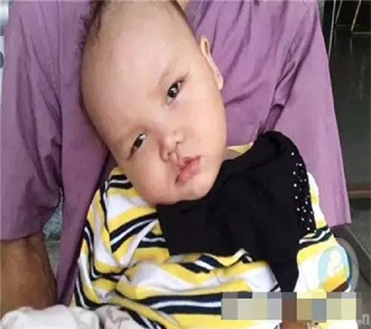 Băng phiến - kẻ thù kinh hoàng với trẻ nhỏ