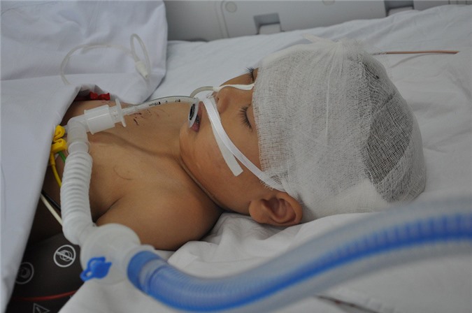 Bé trai 6 tuổi thập tử nhất sinh vì bị chú vô tình bắn súng vào đầu