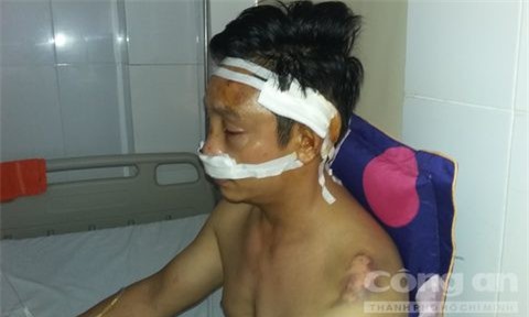 Dùng súng bắn vào đầu bạn học vì dám lấy tên bố ra chào hỏi