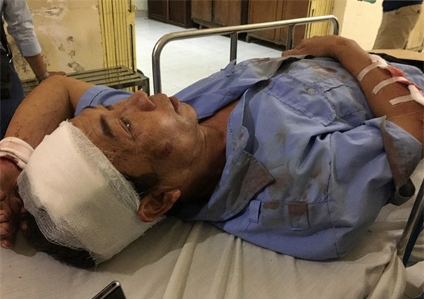 Lật xe khách trên cao tốc: Phút kinh hoàng qua lời kể của nạn nhân