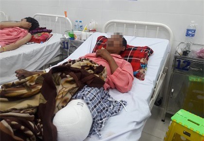 Cha mất tay, chồng mất chân sau vụ nổ kinh hoàng ở vườn điều