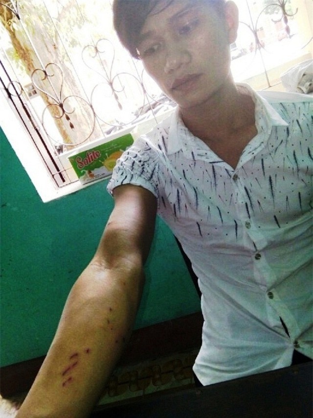 Đi xem văn nghệ, bé gái 15 tuổi bị hiếp dâm