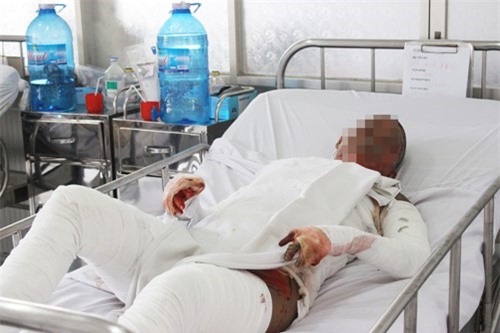 Cô gái không mảnh vải che thân kêu cứu từ căn phòng bị cháy