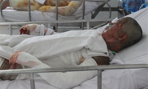 Nạn nhân bị người tình tẩm xăng đốt ở Sài Gòn đã tử vong