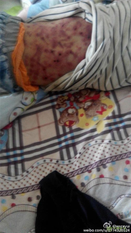 Bé trai 10 tuổi bị cha dượng đánh đập tàn nhẫn