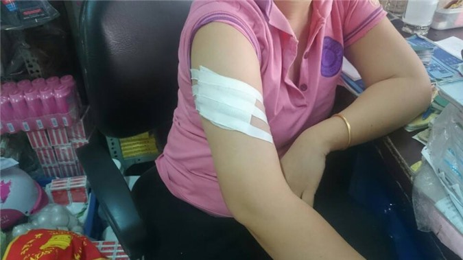 Chém người, cướp 120 triệu giữa phố Sài Gòn