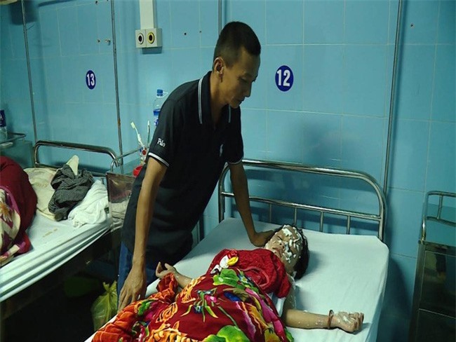 Bóng bay phát nổ đêm trung thu, 9 người bị bỏng nặng