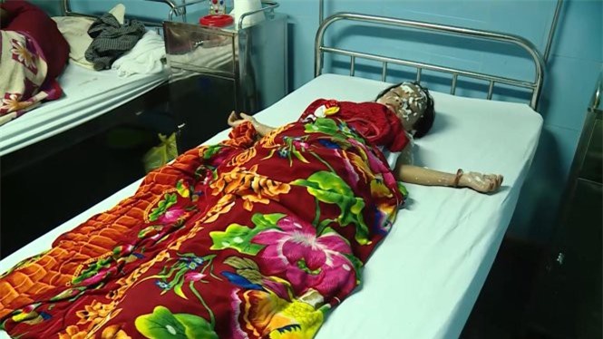 Hé lộ nguyên nhân vụ nổ bóng bay làm 9 người bị thương