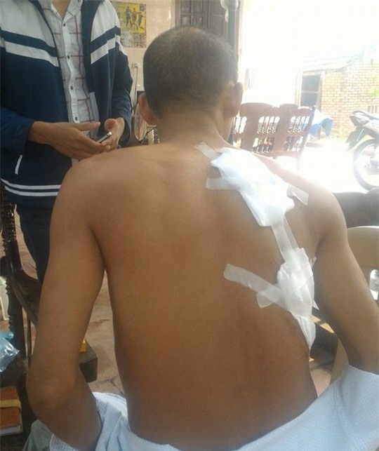 Mâu thuẫn trong đám cưới, vác dao chém 3 hàng xóm nhập viện