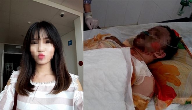 Cô gái xinh đẹp bị bỏng xăng toàn thân đã qua đời
