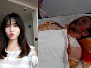 Cô gái xinh đẹp bị bỏng xăng toàn thân đã qua đời