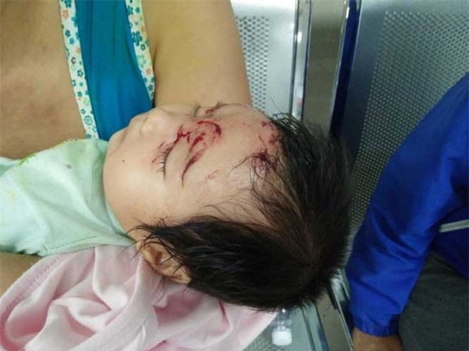 Quảng Bình: Khỉ suýt "bắt cóc" thành công bé gái 2 tháng tuổi