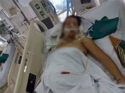 Thai phụ bị xe cán ngang người quyết cứu con trong bụng