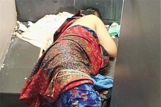 Hy hữu: Người phụ nữ bị kẹt tay trong toilet vì vớt răng giả