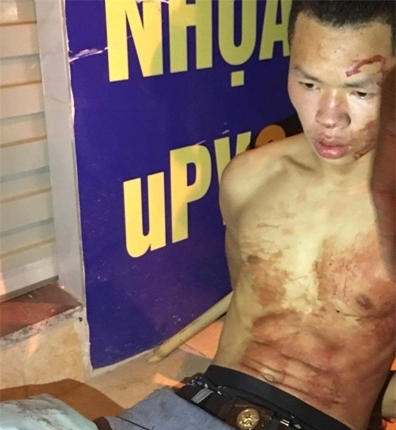 Vụ cứa cổ tài xế, cướp tài sản: Thông tin mới nhất