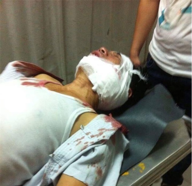 Anh rể xách dao phay chém em vợ gục tại chỗ