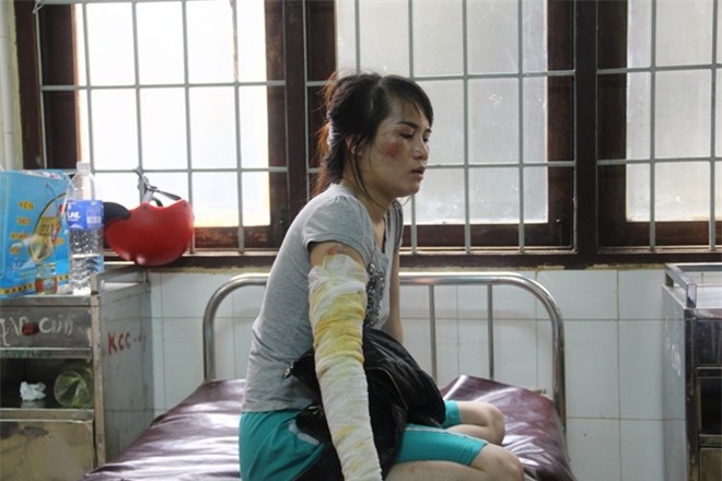 Chồng đổ cả ấm nước sôi lên đầu vợ vì dám đi làm đẹp