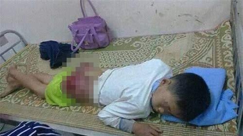 Điều tra vụ ông bố đánh con 13 tuổi tứa máu ở Thái Nguyên