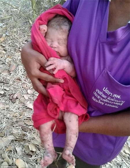 Bé trai 7 tháng tuổi sống sót kì diệu sau khi bị đâm 14 nhát và chôn sống