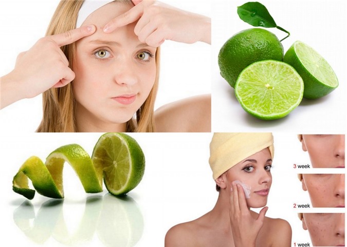 Bí quyết trị mụn tại nhà hiệu quả