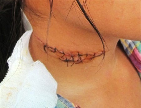 Chồng cầm dao cứa cổ vợ rồi tự sát