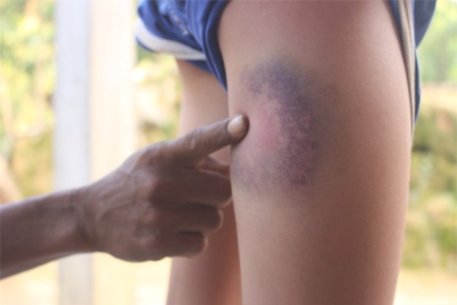 Thầy giáo dạy giỏi đánh 6 học sinh tím đùi nói gì?