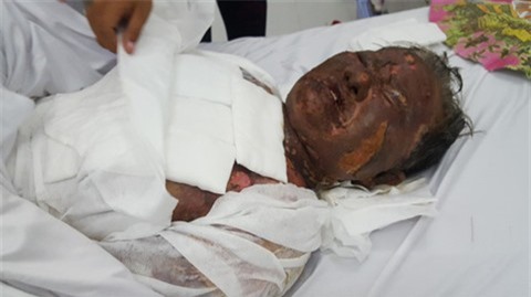 Nghịch tử dùng xăng đốt mẹ ruột