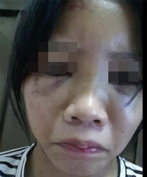 Nữ sinh bị đánh hội đồng, bắt liếm chân kể phút kinh hoàng