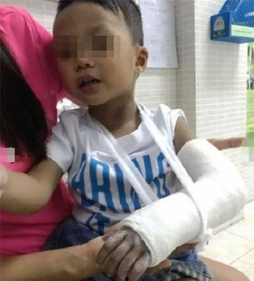 Bé 3 tuổi nghi bị đánh gãy tay: Nhà trường nói gì?