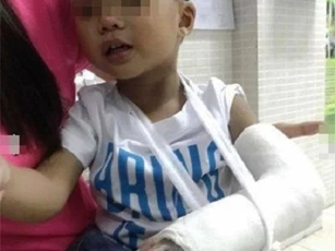 Bé 3 tuổi nghi bị đánh gãy tay: Nhà trường nói gì?