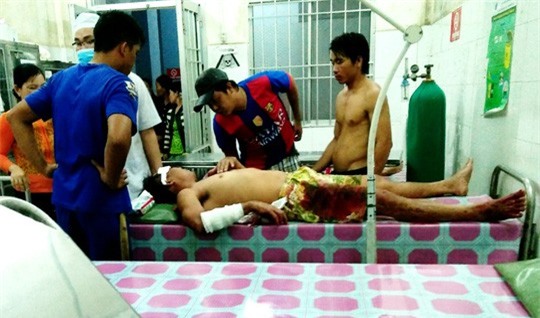 Vợ lên cơn động kinh, chém chồng nhập viện cấp cứu