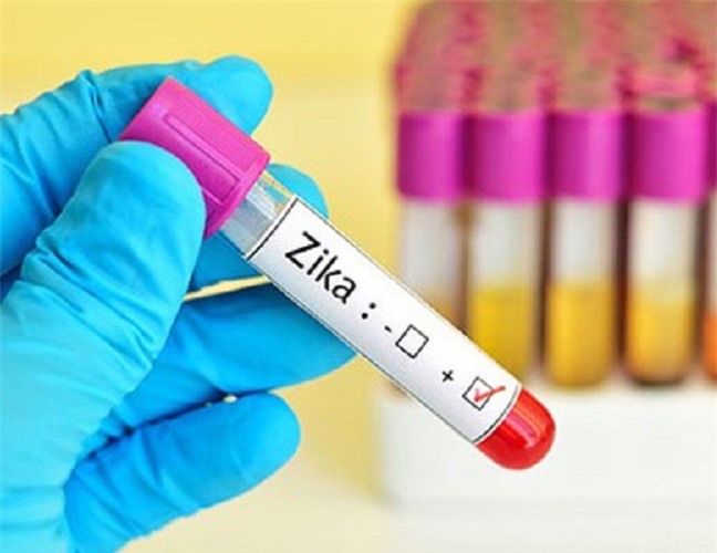 Xuất hiện 29 ca nhiễm virus Zika tại TP. HCM