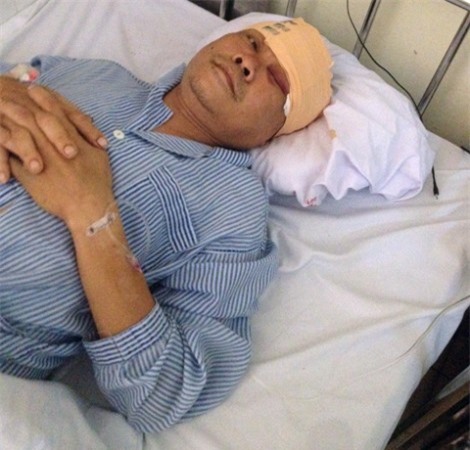 Can đánh nhau, trung tá công an bị chém trọng thương