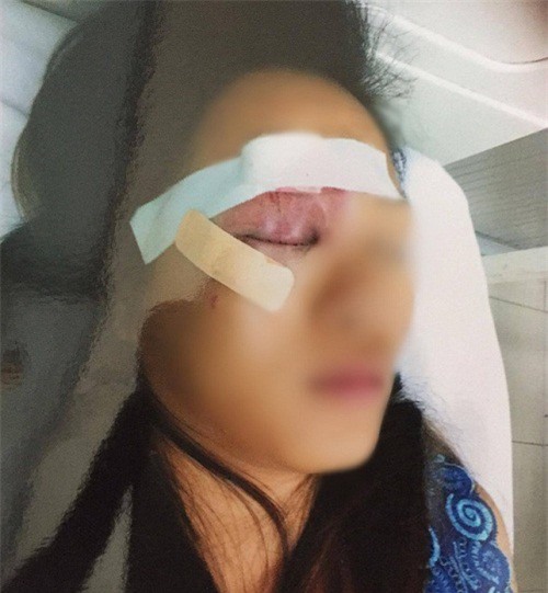 20 thanh niên truy sát kinh hoàng tại bệnh viện Từ Dũ