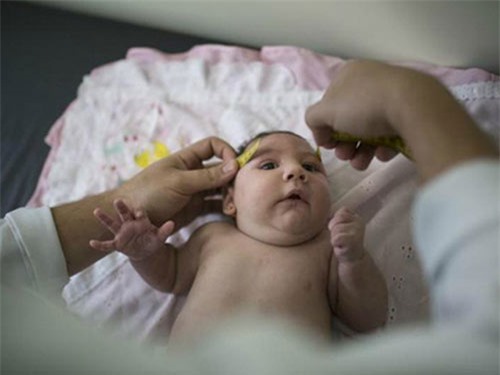Cháu bé sinh ra từ người mẹ nhiễm Zika ở TP.HCM không bị dị tật