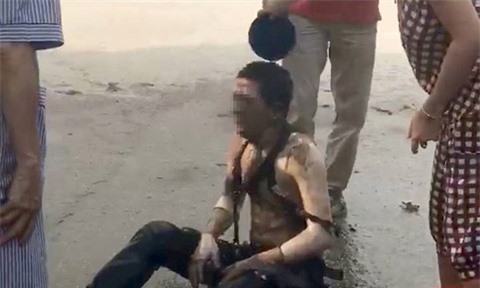 Từ vụ nổ bốt điện ở Hà Đông: Xử lý thế nào khi bị bỏng bất ngờ?