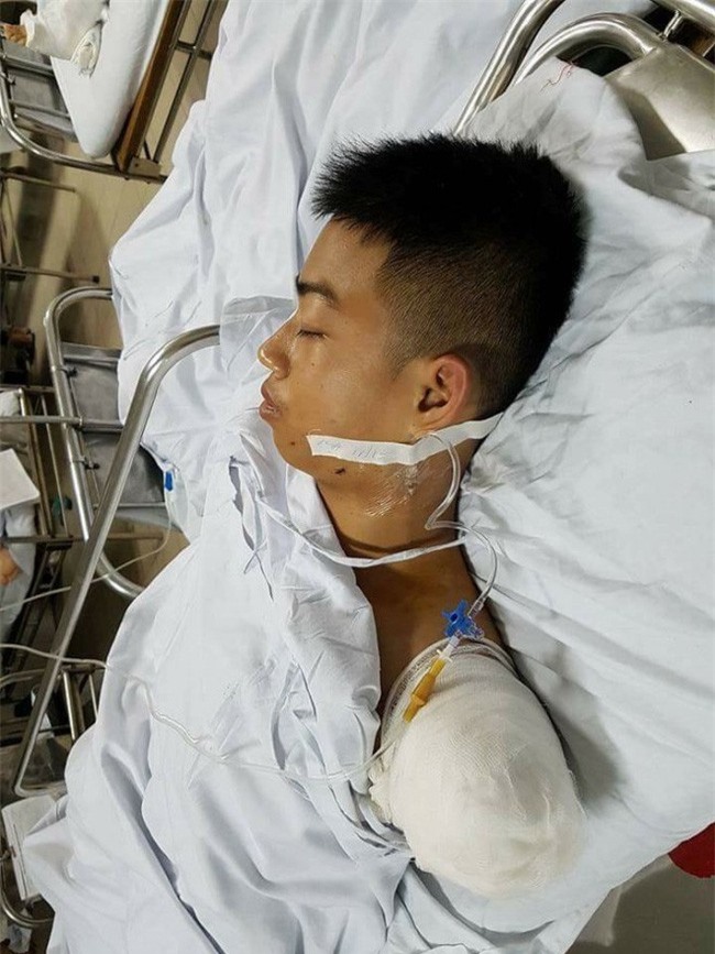 Khâm phục chàng trai hy sinh một cánh tay để cứu sống bạn