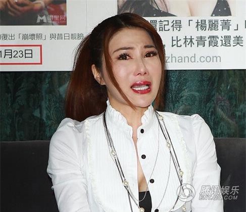 Tiêm botox quá đà, giàn mỹ nhân mặt biến dạng đến khó tin