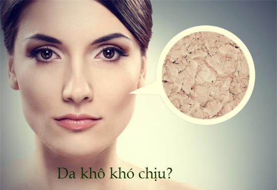 Bí quyết trị mốc da mặt mùa đông cực hiệu quả