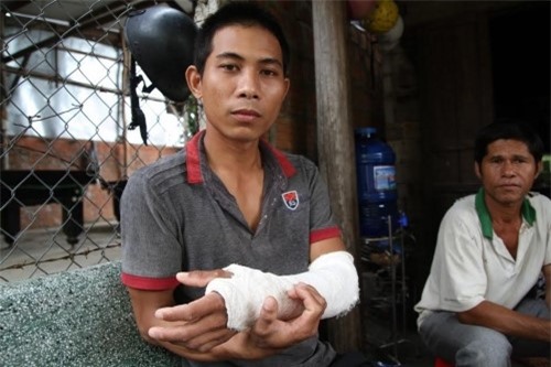 Đề xuất cách chức Trưởng công an xã đánh người chấn thương sọ não