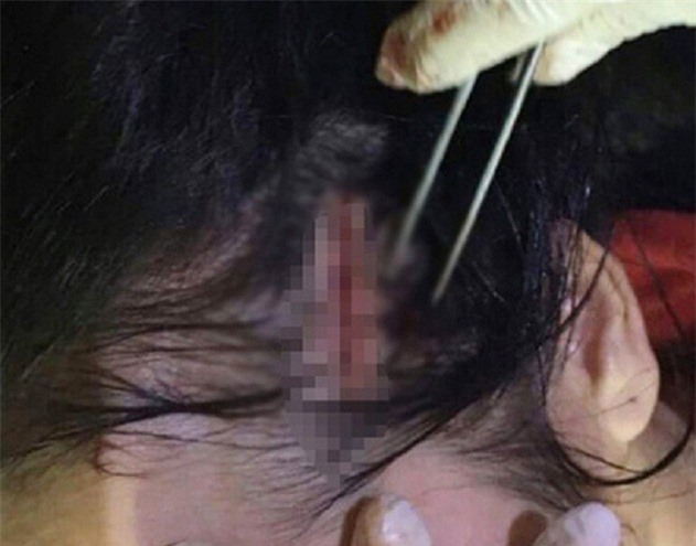 Nữ giáo viên tàn độc bắt cóc cô gái trẻ lên xe taxi hành hung