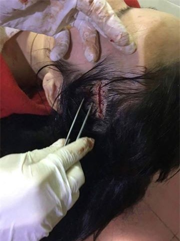 Tạm đình chỉ công tác cô giáo tổ chức đánh người ở Hà Tĩnh