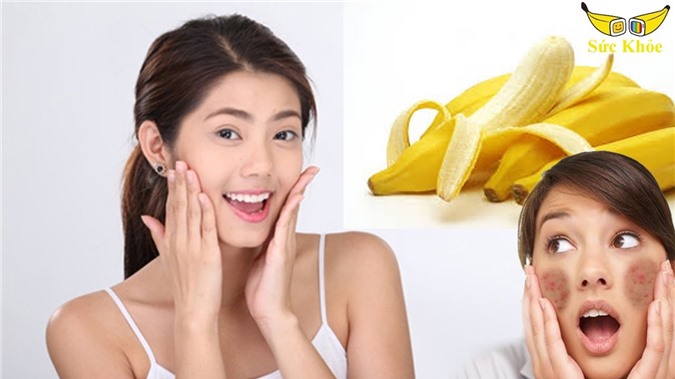 Bí quyết làm đẹp da từ chuối cực hiệu quả