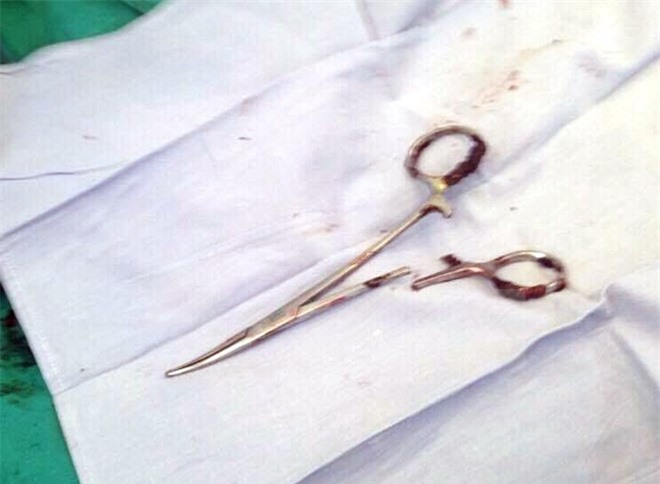 Cận cảnh chiếc kéo nằm trong bụng bệnh nhân 18 năm