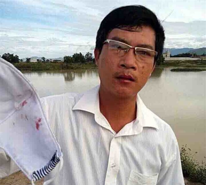 Triệu tập giám đốc doanh nghiệp đánh Phó chủ tịch xã nhập viện