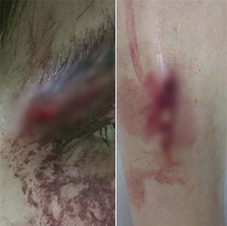Thử đồ mà không mua, nữ sinh Hà Nội bị đánh chảy máu đầu