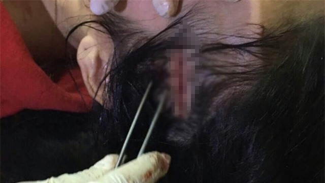 Vụ cô giáo "nhốt" thiếu nữ trên taxi, hành hung: Tin mới nhất