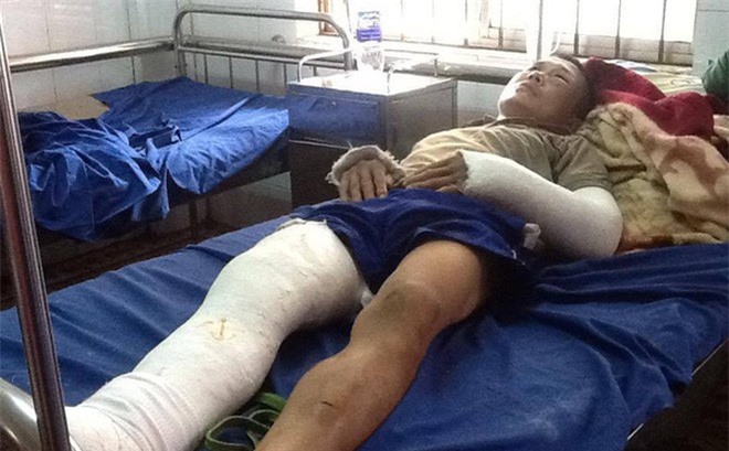Bị đánh gãy 3 xương sườn vì đòi tiền công gửi về quê sắm Tết
