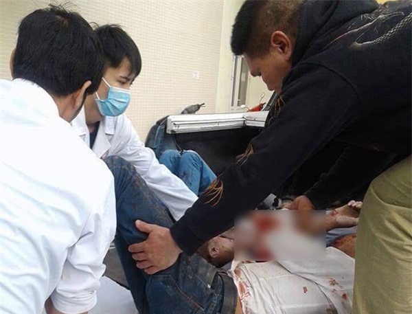 Tai nạn 29 người thương vong: Một nạn nhân đang nguy kịch