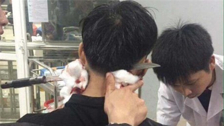Kinh hoàng nam thanh niên bị đâm xuyên gáy may mắn sống sót